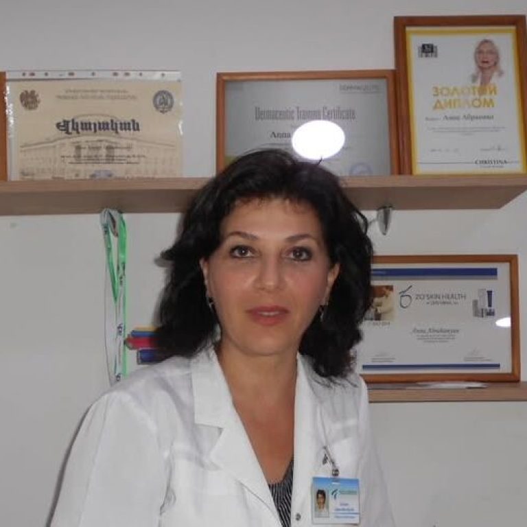 anna abrahamyan